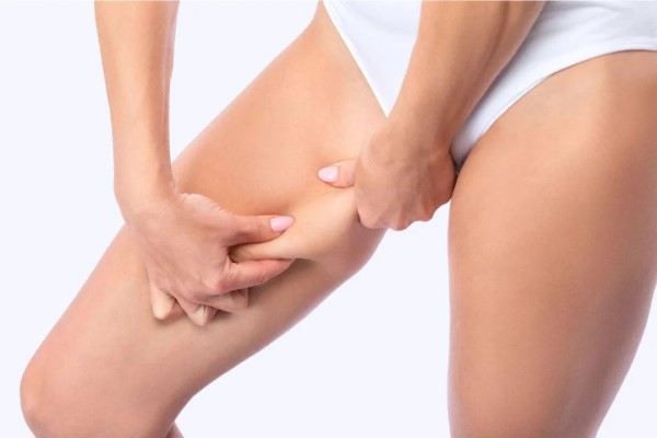 Mỡ đùi gây ảnh hưởng đáng kể đến sức khỏe