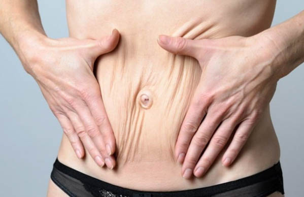 Nguy cơ sức khỏe và mặt trái của giảm cân cấp tốc
